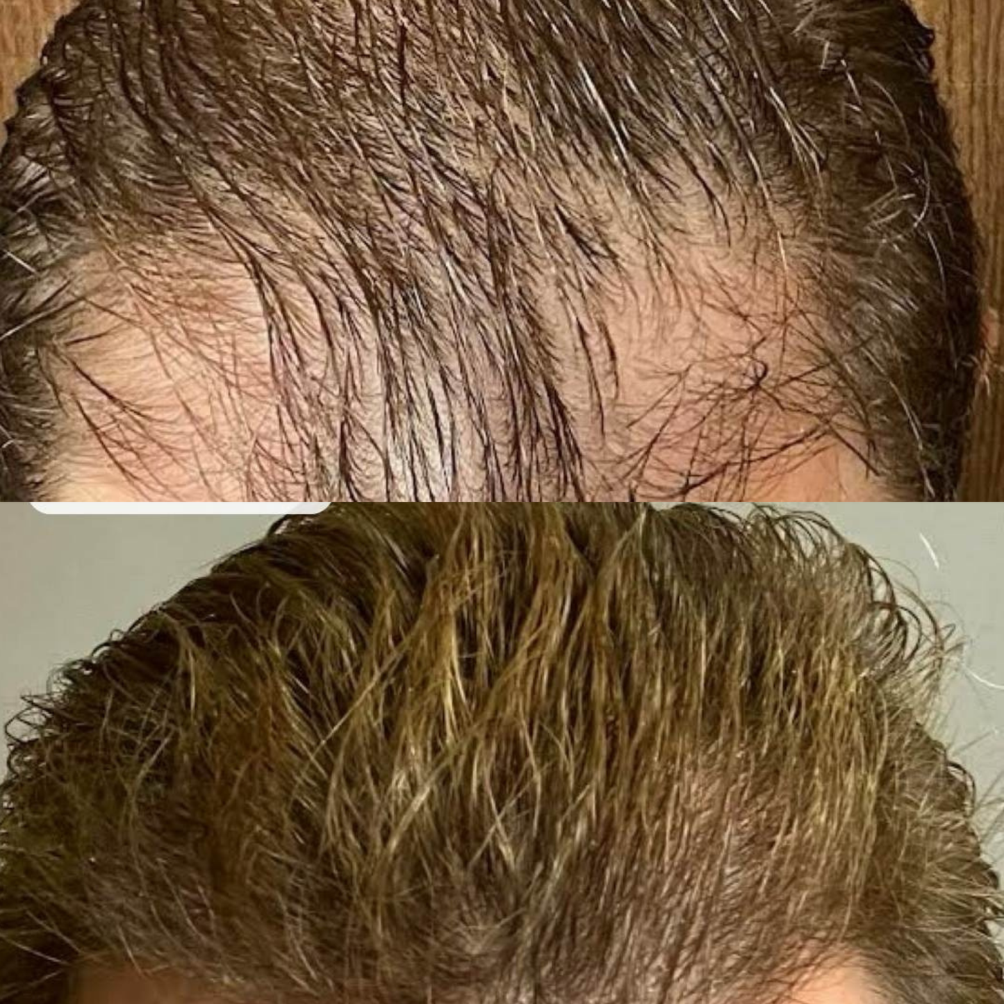 Reclaim – Sérum Repousse