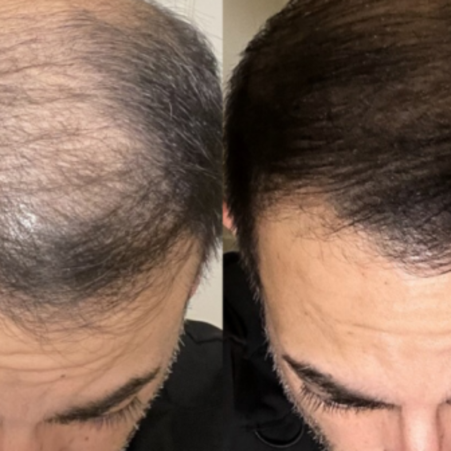 Reclaim – Sérum Repousse