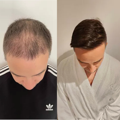 Reclaim – Sérum Repousse